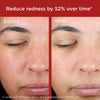 EltaMD UV Skin Recovery Red Color Correcting Green Tint Broad Spectrum SPF 50